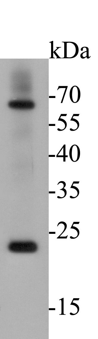 Fig1: Western blot analysis of CD68 on human lung tissue lysates. Proteins were transferred to a PVDF membrane and blocked with 5% BSA in PBS for 1 hour at room temperature. The primary antibody ( 1/500) was used in 5% BSA at room temperature for 2 hours. Goat Anti-Rabbit IgG - HRP Secondary Antibody (HA1001) at 1:5,000 dilution was used for 1 hour at room temperature.