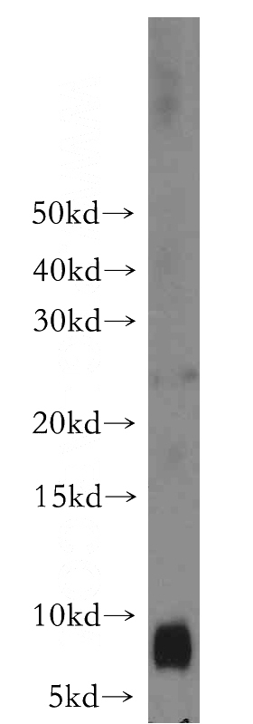 K-562 cells were subjected to SDS PAGE followed by western blot with Catalog No:114965(S100A8 antibody) at dilution of 1:1000