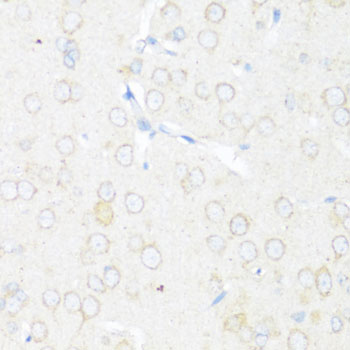 Immunohistochemistry - EIF3J Polyclonal Antibody 