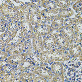 Immunohistochemistry - DNAJA3 Polyclonal Antibody 