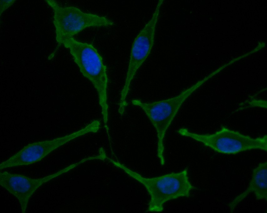 Fig3:; ICC staining of IL-7 in SH-SY5Y cells (green). Formalin fixed cells were permeabilized with 0.1% Triton X-100 in TBS for 10 minutes at room temperature and blocked with 10% negative goat serum for 15 minutes at room temperature. Cells were probed with the primary antibody ( 1/50) for 1 hour at room temperature, washed with PBS. Alexa Fluor®488 conjugate-Goat anti-Rabbit IgG was used as the secondary antibody at 1/1,000 dilution. The nuclear counter stain is DAPI (blue).