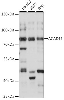 Western blot - ACAD11 Polyclonal Antibody 