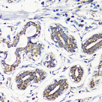 Immunohistochemistry - MMP16 Polyclonal Antibody 