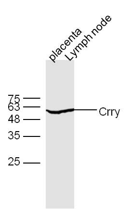 Fig1: Protein:; placenta(mouse) lyates at 40ug; lymph node(mouse) lyates at 40ug;; Primary: Rabbit Anti-Crry at 1:300;; Secondary: 800CW Conjugated Goat (polyclonal) Anti-Rabbit IgG(H+L) at 1: 10000;; Predicted band size:58 kD Observed band size:58 kD