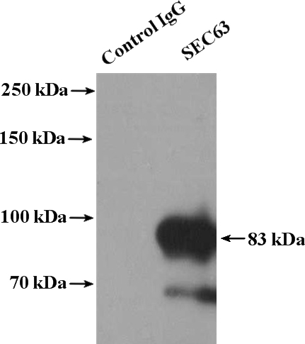IP Result of anti-SEC63 (IP:Catalog No:115090, 4ug; Detection:Catalog No:115090 1:300) with A431 cells lysate 2400ug.