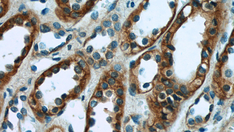 Immunohistochemistry of paraffin-embedded human kidney tissue slide using Catalog No:116757(VIPR1 Antibody) at dilution of 1:50 (under 40x lens)