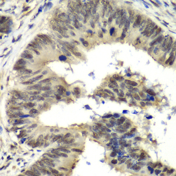 Immunohistochemistry - NELFE Polyclonal Antibody 