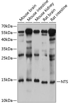 Western blot - NTS Polyclonal Antibody 