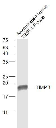 Fig4: Sample:; Recombinant human TIMP-1 Protein Lysate at 40 ug; Primary: Anti-TIMP-1 at 1/50000 dilution; Secondary: IRDye800CW Goat Anti-Rabbit IgG at 1/20000 dilution; Predicted band size: 21 kD; Observed band size: 19 kD