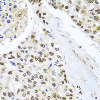 Immunohistochemistry - BNIP3L Polyclonal Antibody 