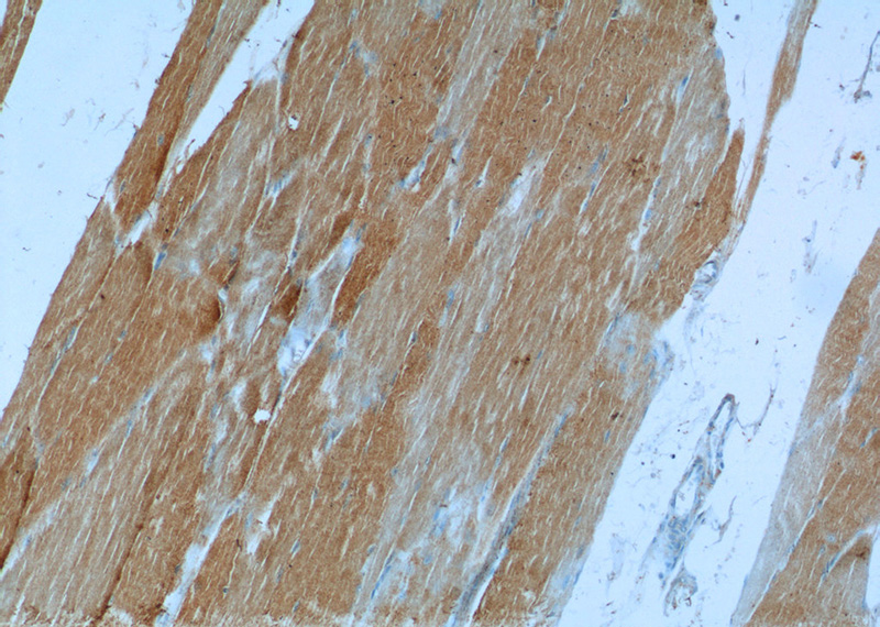 Immunohistochemistry of paraffin-embedded human skeletal muscle tissue slide using Catalog No:113820(PHKB Antibody) at dilution of 1:50 (under 10x lens)
