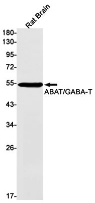 Western blot detection of ABAT/GABA-T in Rat Brain lysates using ABAT/GABA-T Rabbit mAb(1:1000 diluted).Predicted band size:56kDa.Observed band size:56kDa.