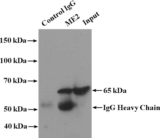 IP Result of anti-ME2 (IP:Catalog No:112575, 4ug; Detection:Catalog No:112575 1:500) with HeLa cells lysate 3200ug.