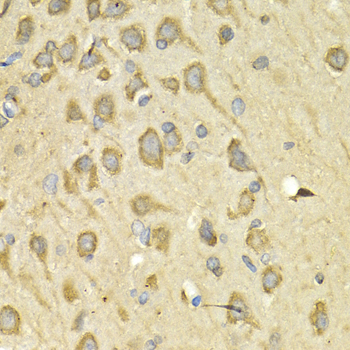 Immunohistochemistry - IL10RA Polyclonal Antibody 