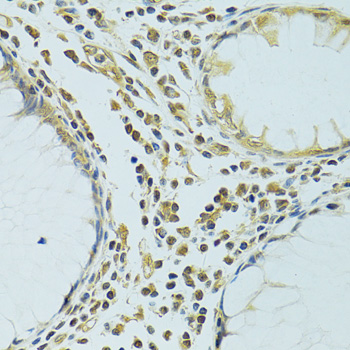 Immunohistochemistry - METTL13 Polyclonal Antibody 