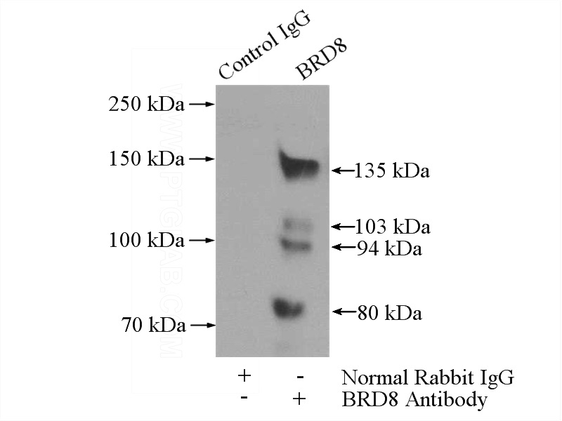 IP Result of anti-BRD8 (IP:Catalog No:117230, 4ug; Detection:Catalog No:117230 1:300) with HeLa cells lysate 1200ug.
