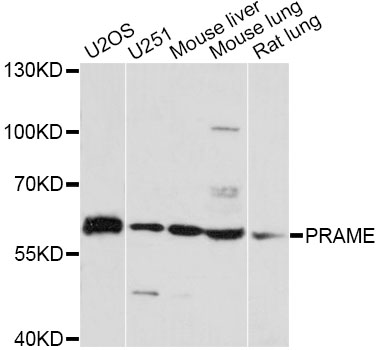 Western blot - PRAME Polyclonal Antibody 