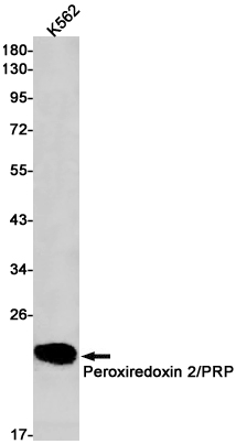 Western blot detection of Peroxiredoxin 2/PRP in K562 cell lysates using Peroxiredoxin 2/PRP Rabbit pAb(1:1000 diluted).Predicted band size:22kDa.Observed band size:22kDa.