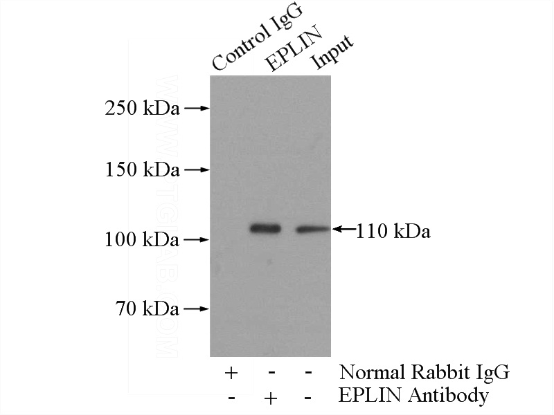 IP Result of anti-LIMA1 (IP:Catalog No:110388, 4ug; Detection:Catalog No:110388 1:500) with mouse liver tissue lysate 4000ug.