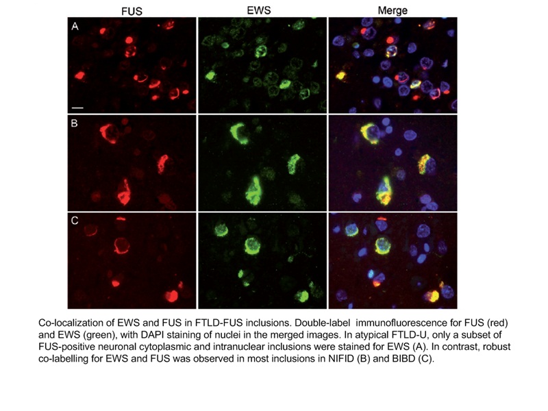 IF result of McAB FUS(Catalog No:107282) in the Paper 