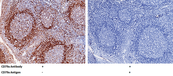 CD79a Antibody, Rabbit PAb, Antigen Affinity Purified, Immunohistochemistry