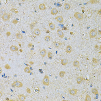 Immunohistochemistry - CAMK1G Polyclonal Antibody 