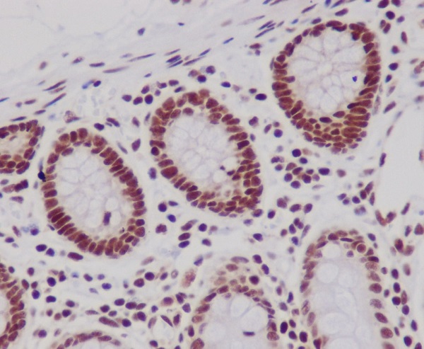 Immunohistochemical analysis of paraffin-embedded human colon, using Histone H3 Antibody.