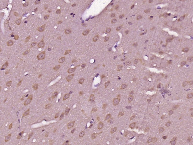 Fig1: Paraformaldehyde-fixed, paraffin embedded (Rat brain); Antigen retrieval by boiling in sodium citrate buffer (pH6.0) for 15min; Block endogenous peroxidase by 3% hydrogen peroxide for 20 minutes; Blocking buffer (normal goat serum) at 37℃ for 30min; Antibody incubation with (GPR89A) Polyclonal Antibody, Unconjugated at 1:400 overnight at 4℃, followed by operating according to SP Kit(Rabbit) (sp-0023) instructionsand DAB staining.