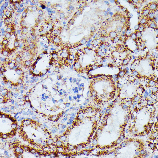 Immunohistochemistry - IDH3A Polyclonal Antibody 
