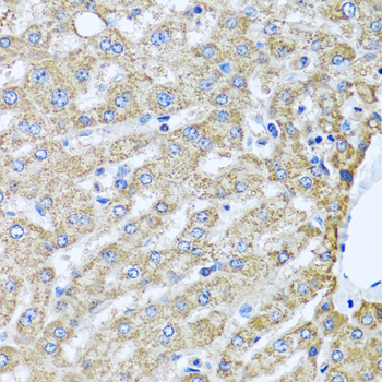 Immunohistochemistry - TMEM189 Polyclonal Antibody 