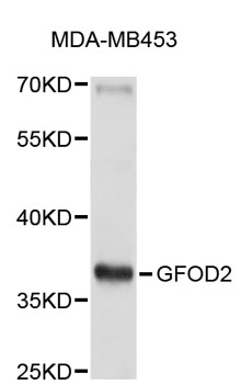Western blot - GFOD2 Polyclonal Antibody 