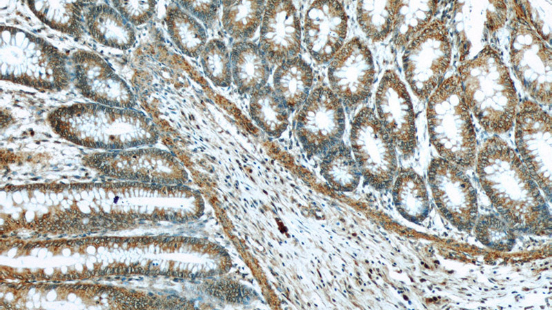 Immunohistochemistry of paraffin-embedded human colon slide using Catalog No:113300(NOMO1 Antibody) at dilution of 1:50
