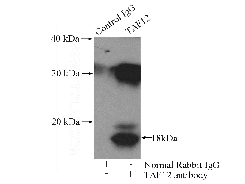 IP Result of anti-TAF12 (IP:Catalog No:115978, 4ug; Detection:Catalog No:115978 1:300) with Y79 cells lysate 2000ug.