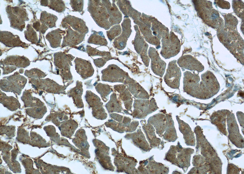 Immunohistochemistry of paraffin-embedded human heart tissue slide using Catalog No:115185(SH3BGR Antibody) at dilution of 1:50 (under 40x lens)