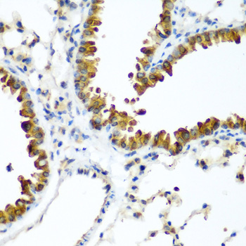 Immunohistochemistry - TAZ Polyclonal Antibody 