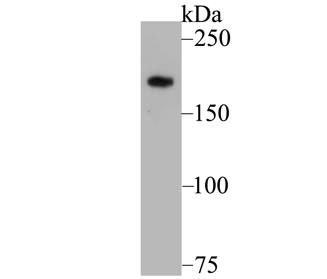 Fig1:; Western blot analysis of Gli3 on PC-3M cell lysates. Proteins were transferred to a PVDF membrane and blocked with 5% BSA in PBS for 1 hour at room temperature. The primary antibody ( 1/500) was used in 5% BSA at room temperature for 2 hours. Goat Anti-Rabbit IgG - HRP Secondary Antibody (HA1001) at 1:200,000 dilution was used for 1 hour at room temperature.