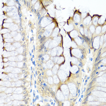 Immunohistochemistry - INHBC Polyclonal Antibody 