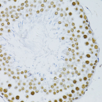 Immunohistochemistry - SNRNP70 Polyclonal Antibody 