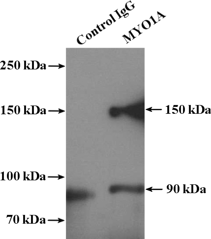 IP Result of anti-MYO1A (IP:Catalog No:112982, 4ug; Detection:Catalog No:112982 1:500) with HeLa cells lysate 3200ug.