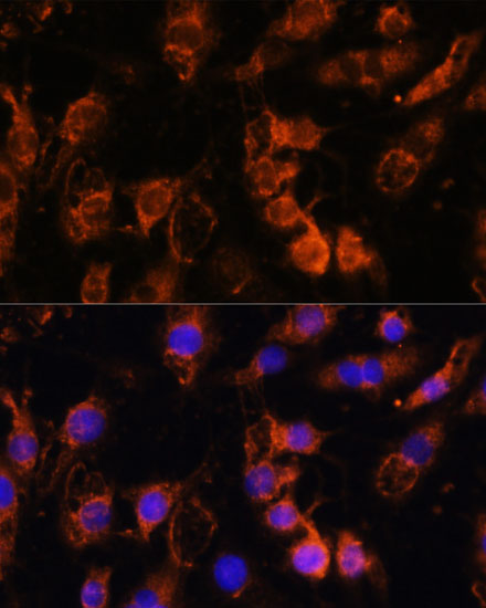 Immunofluorescence - FGA Polyclonal Antibody 