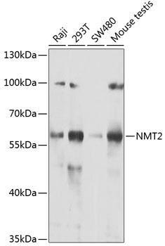 Western blot - NMT2 Polyclonal Antibody 