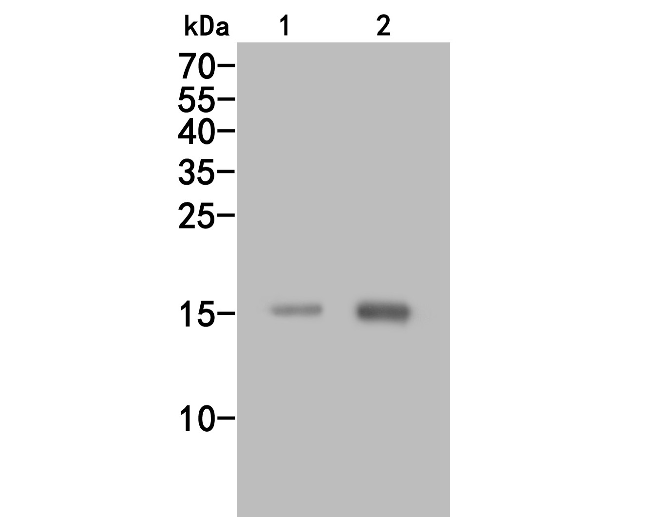 Fig1:; Western blot analysis of CCL2/MCP1 on different lysates. Proteins were transferred to a PVDF membrane and blocked with 5% BSA in PBS for 1 hour at room temperature. The primary antibody ( 1/500) was used in 5% BSA at room temperature for 2 hours. Goat Anti-Rabbit IgG - HRP Secondary Antibody (HA1001) at 1:5,000 dilution was used for 1 hour at room temperature.; Positive control:; Lane 1: A549 cell lysate; Lane 2: Hela cell lysate