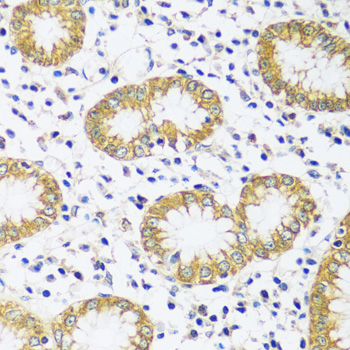 Immunohistochemistry - CADPS Polyclonal Antibody 