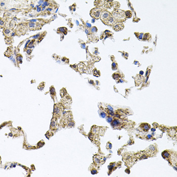 Immunohistochemistry - PKN1 Polyclonal Antibody 