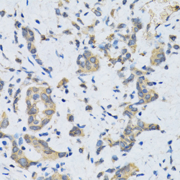 Immunohistochemistry - SLC2A13 Polyclonal Antibody 