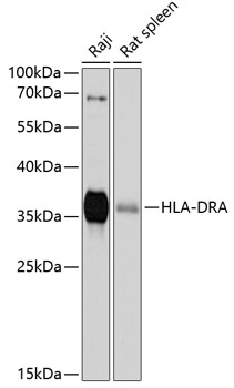 Western blot - HLA-DRA Polyclonal Antibody 