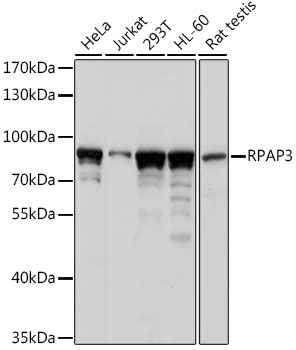 Western blot - RPAP3 Polyclonal Antibody 