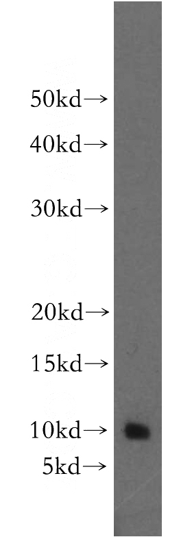 human brain tissue were subjected to SDS PAGE followed by western blot with Catalog No:117134(BEX2 antibody) at dilution of 1:500