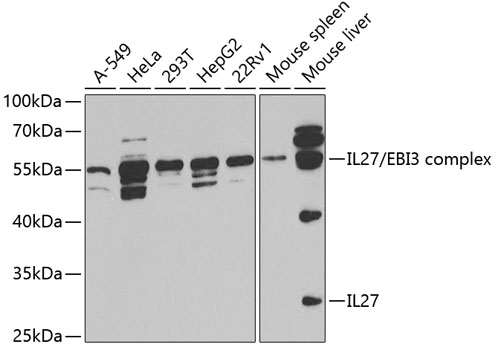Western blot - IL27 Polyclonal Antibody 