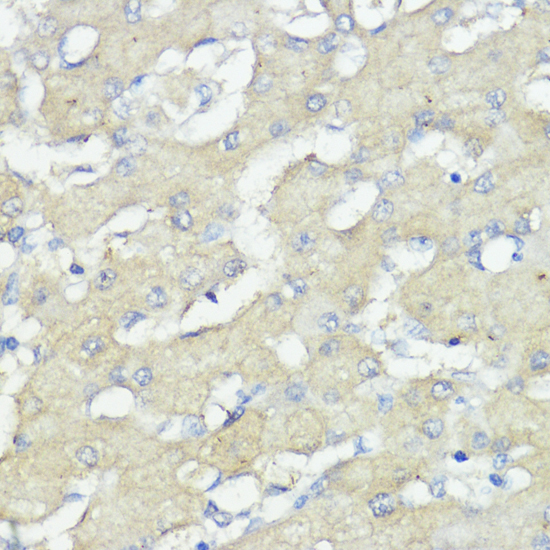 Immunohistochemistry - NOD1 Polyclonal Antibody 